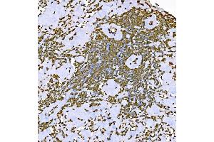 IHC analysis of Histone H1. (Histone H1 anticorps  (AA 20-159))