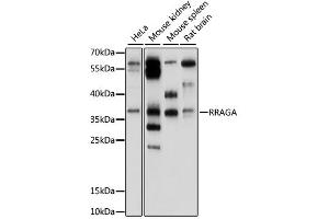 Western blot analysis of extracts of various cell lines, using RRAGA antibody (ABIN6293916) at 1:1000 dilution.