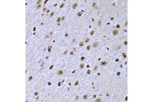 Immunohistochemistry of paraffin-embedded mouse brain using SOX5 antibody (ABIN5974201) at dilution of 1/100 (40x lens). (SOX5 anticorps)