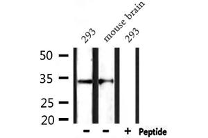 Western blot analysis of extracts from 293 and mouse brain, using CD38 Antibody. (CD38 anticorps  (Internal Region))