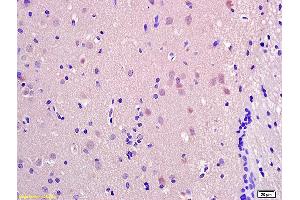 Formalin-fixed and paraffin embedded rat brain labeled with Anti-SRRM2 Polyclonal Antibody, Unconjugated (ABIN873267) at 1:200 followed by conjugation to the secondary antibody and DAB staining. (SRRM2 anticorps  (AA 101-230))