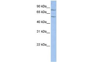 Western Blotting (WB) image for anti-T-Complex-Associated-Testis-Expressed 1 (TCTE1) antibody (ABIN2459674)