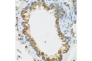 Immunohistochemistry of paraffin-embedded rat lung using PI3 antibody (ABIN6293676) at dilution of 1:100 (40x lens). (PI3 anticorps)