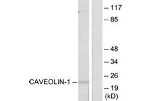 Western blot analysis of extracts from NIH-3T3 cells, using Caveolin-1 (Ab-14) Antibody. (Caveolin-1 anticorps  (AA 5-54))