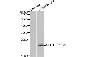 Western blot analysis of extracts from MDA-MB-435 cells, using Phospho-EIF4EBP1-T36 antibody. (eIF4EBP1 anticorps  (pThr36))