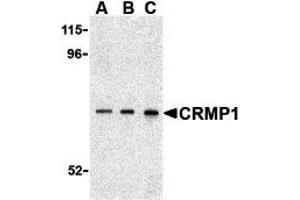 Western Blotting (WB) image for anti-Collapsin Response Mediator Protein 1 (CRMP1) (C-Term) antibody (ABIN1030345)