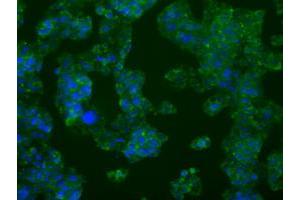 Anti-PFKFB4 mouse monoclonal antibody (ABIN2453452) immunofluorescent staining of COS7 cells transiently transfected by pCMV6-ENTRY PFKFB4 (RC201573).