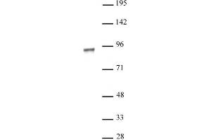 NR3C1 antibody (pAb) tested by Western blot. (Glucocorticoid Receptor anticorps)