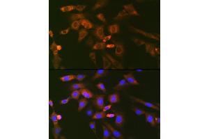 Immunofluorescence analysis of NIH-3T3 cells using Ube2N/Ubc13 Rabbit mAb (ABIN7271179) at dilution of 1:100 (40x lens). (UBE2N anticorps)
