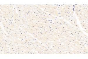 Detection of LOX in Human Cardiac Muscle Tissue using Polyclonal Antibody to Lysyl Oxidase (LOX)