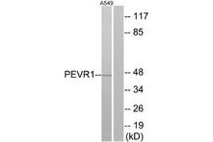 Western Blotting (WB) image for anti-G Protein-Coupled Receptor 172A (GPR172A) (AA 43-92) antibody (ABIN2891074) (GPR172A anticorps  (AA 43-92))