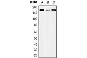Western blot analysis of CIC expression in HEK293T (A), Raw264. (CIC anticorps  (Center))