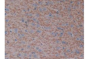 DAB staining on IHC-P; Samples: Rat Cerebrum Tissue