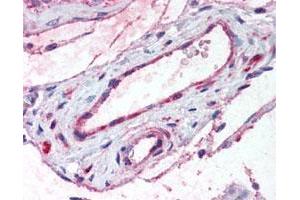 Immunohistochemical (Formalin/PFA-fixed paraffin-embedded sections) staining in vessels of human testis. (ADAMTS1 anticorps)