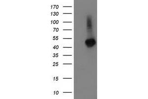 Image no. 1 for anti-Tubulin Folding Cofactor E-Like (TBCEL) antibody (ABIN1501325) (TBCEL anticorps)