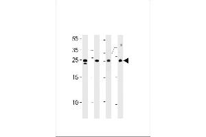 TSN Antibody (Center) (ABIN656310 and ABIN2845612) western blot analysis in HL-60,Jurkat,K562 cell line mouse spleen tissue lysates (35 μg/lane). (Translin anticorps  (AA 109-138))