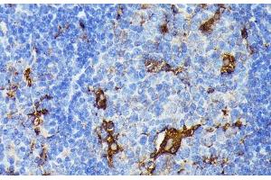 Immunohistochemistry of paraffin-embedded Mouse spleen using TIAL1 Polyclonal Antibody at dilution of 1:100 (40x lens). (TIAL1 anticorps)