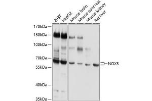Western blot analysis of extracts of various cell lines, using NOX3 antibody (ABIN6129307, ABIN6144750, ABIN6144751 and ABIN6220324) at 1:1000 dilution.