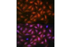 Immunofluorescence analysis of U-2 OS cells using PP1 beta Rabbit mAb (ABIN1679819, ABIN3018859, ABIN3018860 and ABIN7101675) at dilution of 1:100 (40x lens).