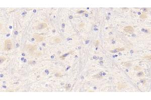 Detection of NRG1 in Mouse Cerebrum Tissue using Polyclonal Antibody to Neuregulin 1 (NRG1)