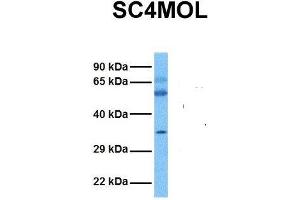 Host:  Rabbit  Target Name:  SC4MOL  Sample Tissue:  Human Ovary Tumor  Antibody Dilution:  1.