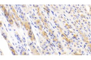 Detection of NFKB3 in Mouse Stomach Tissue using Polyclonal Antibody to Transcription Factor P65 (NFKB3)