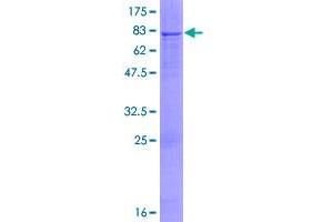 Image no. 1 for N-Sulfoglucosamine Sulfohydrolase (SGSH) (AA 1-502) protein (GST tag) (ABIN1319846)