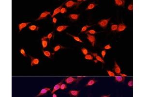 Immunofluorescence analysis of C6 cells using TriMethyl-Histone H3-K14 Polyclonal Antibody at dilution of 1:100 (40x lens). (Histone 3 anticorps  (3meLys14))