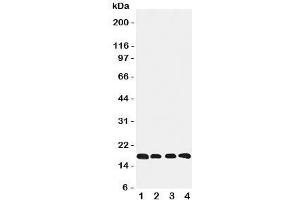 Western blot testing of Cyclophilin B antibody and Lane 1:  rat ovary;  2: HeLa;  3: 293T;  4: A431 cell lysate (PPIB anticorps  (C-Term))