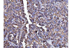 IHC analysis of CD147/Emmprin using anti-CD147/Emmprin antibody (ABIN7599997).