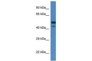WB Suggested Anti-Sbk1 Antibody   Titration: 1. (SBK1 anticorps  (C-Term))