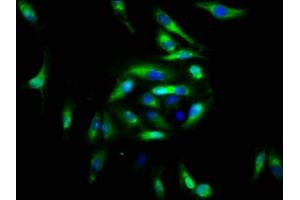 Immunofluorescence staining of Hela cells with ABIN7152853 at 1:166, counter-stained with DAPI.