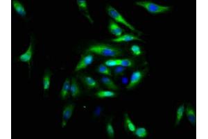 Immunofluorescence staining of Hela cells with ABIN7152853 at 1:166, counter-stained with DAPI. (FGFRL1 anticorps  (AA 403-470))