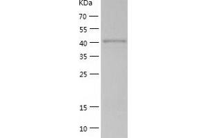 Western Blotting (WB) image for RAD52 Homolog (S. Cerevisiae) (RAD52) (AA 1-418) protein (His tag) (ABIN7124770)