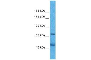 Host:  Rabbit  Target Name:  ZNF606  Sample Type:  Lung Tumor lysates  Antibody Dilution:  1. (ZNF606 anticorps  (Middle Region))
