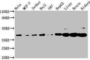 Western Blot Positive WB detected in: Hela whole cell lysate, MCF-7 whole cell lysate, Jurkat whole cell lysate, Raji whole cell lysate, U87 whole cell lysate, HepG2 whole cell lysate, Rat liver tissue, Mouse brain tissue, Mouse kidney tissue All lanes: PNCK antibody at 3. (PNCK anticorps  (AA 1-115))