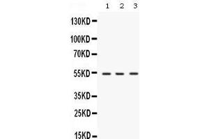 Western blot analysis of SPTLC1 expression in rat brain extract (lane 1), mouse brain extract (lane 2) and MCF-7 whole cell lysates (lane 3). (SPTLC1 anticorps  (C-Term))