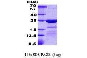Figure annotation denotes ug of protein loaded and % gel used. (HN1L Protéine)