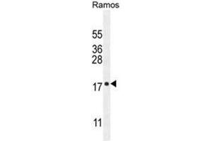 C11orf53 Antibody (C-term) western blot analysis in Ramos cell line lysates (35µg/lane). (C11orf53 anticorps  (C-Term))
