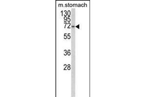 Western blot analysis of TCERG1L Antibody (Center) (ABIN652828 and ABIN2842540) in mouse stomach tissue lysates (35 μg/lane). (TCERG1L anticorps  (AA 392-421))