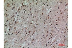 Immunohistochemistry (IHC) analysis of paraffin-embedded Human Brain, antibody was diluted at 1:100.