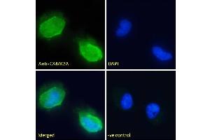 (ABIN570984) Immunofluorescence analysis of paraformaldehyde fixed U251 cells, permeabilized with 0. (CaMKII alpha/beta (Internal Region) anticorps)