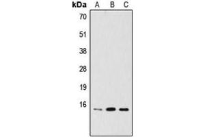 Western blot analysis of PDRG1 expression in HeLa (A), MCF7 (B), A2058 (C) whole cell lysates.