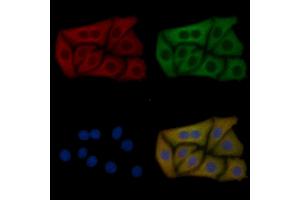 BCL7C Mouse Monoclonal Antibody staining Hela cells by IF/ICC.
