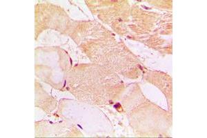 Immunohistochemical analysis of Dysferlin staining in human muscle formalin fixed paraffin embedded tissue section. (Dysferlin anticorps  (C-Term))