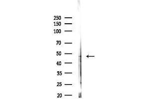 anti-Carbohydrate (Chondroitin 4) Sulfotransferase 12 (CHST12) (C-Term) antibody