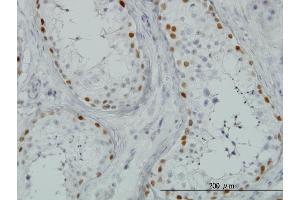 Immunoperoxidase of monoclonal antibody to SALL4 on formalin-fixed paraffin-embedded human testis.