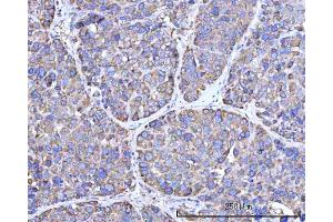 IHC analysis of RPN1 using anti-RPN1 antibody (ABIN7600447). (RPN1 anticorps  (AA 196-495))