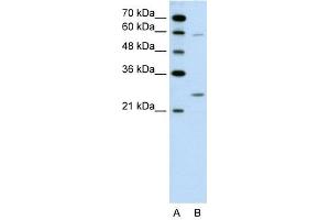 GAMT antibody used at 0. (GAMT anticorps  (N-Term))
