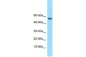 WB Suggested Anti-IFIT1 Antibody Titration: 1. (IFIT1 anticorps  (C-Term))